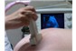 Ultrasonografia Convencional