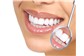 Tratameto Estético Dentario no Centro