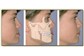 Cirurgia Buco-Maxilo-Facial no Tauape 