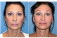 Clínica de Rejuvenescimento Facial Prox. Iguatemi