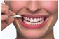 Implante Dentário no Centro