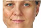 Clareamento de Manchas Facial Prox. Salinas